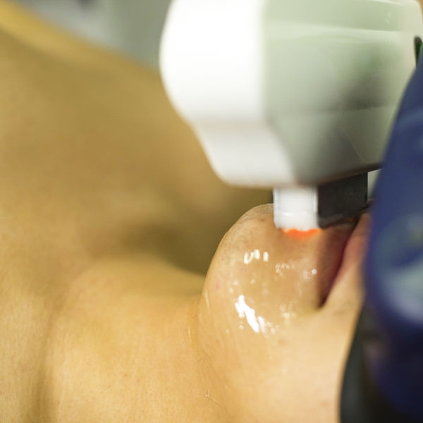 どろぼうひげでお悩みの方にメンズ脱毛サロンVR脱毛をおすすめいたします